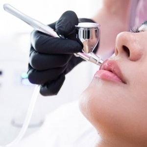 Infuzja tlenowa Intraceuticals