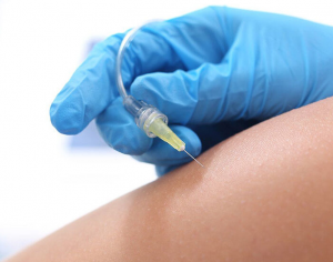 KARBOXYTERAPIA 15% TANIEJ